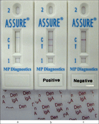 Image: The ASSURE Dengue IgA Rapid test (Photo courtesy of MP Diagnostics).